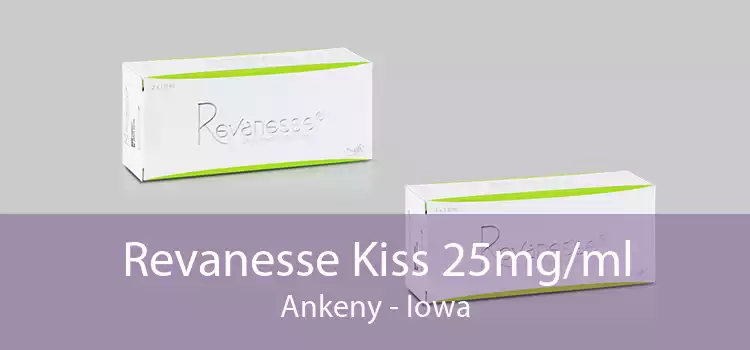 Revanesse Kiss 25mg/ml Ankeny - Iowa