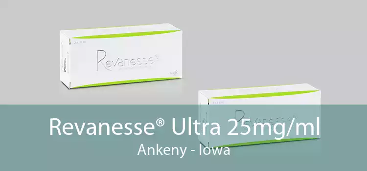 Revanesse® Ultra 25mg/ml Ankeny - Iowa